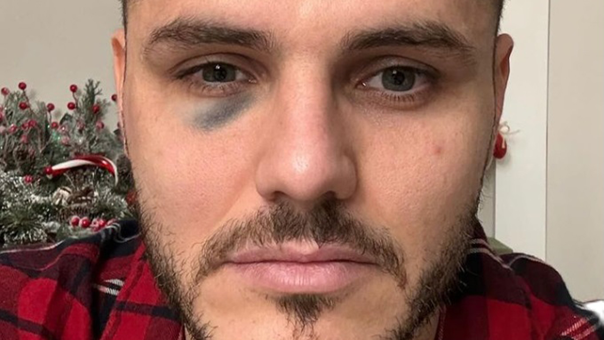 Icardi, novità importanti sull’ex obiettivo della Juventus: definito il suo futuro e un retroscena a sorpresa su un rifiuto all’Arabia… Icardi, novità importanti sull’ex obiettivo della Juventus: definito il suo futuro e un retroscena a sorpresa su un rifiuto all’Arabia…